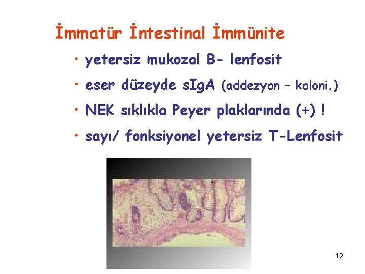 İmmatür İntestinal İmmünite • yetersiz mukozal B- lenfosit • eser düzeyde s. Ig. A