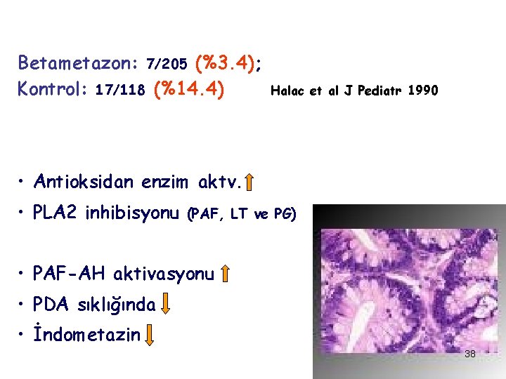 Betametazon: 7/205 (%3. 4); Kontrol: 17/118 (%14. 4) Halac et al J Pediatr 1990