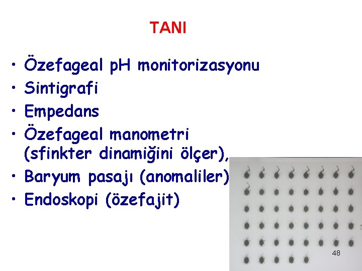 TANI • • Özefageal p. H monitorizasyonu Sintigrafi Empedans Özefageal manometri (sfinkter dinamiğini ölçer),