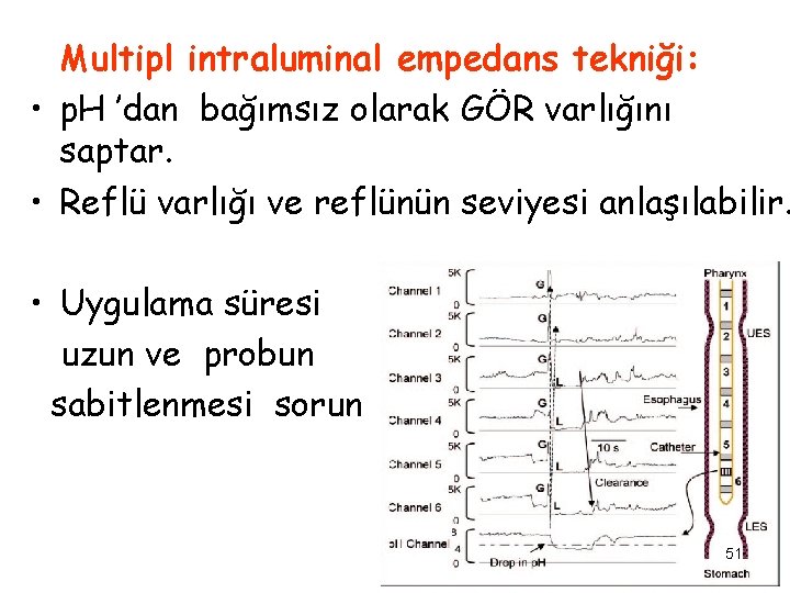 Multipl intraluminal empedans tekniği: • p. H ’dan bağımsız olarak GÖR varlığını saptar. •