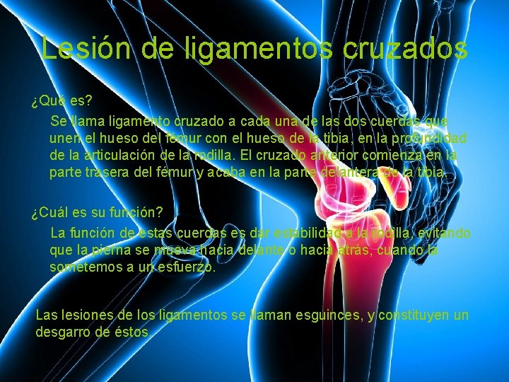 Lesión de ligamentos cruzados ¿Qué es? Se llama ligamento cruzado a cada una de