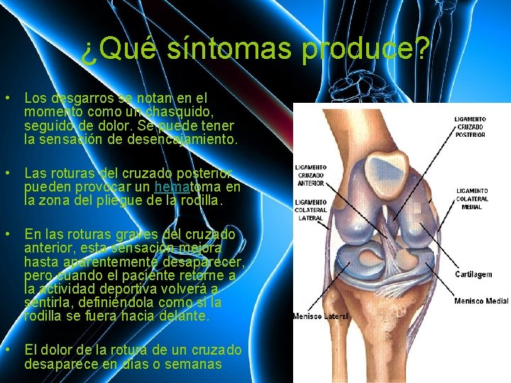 ¿Qué síntomas produce? • Los desgarros se notan en el momento como un chasquido,