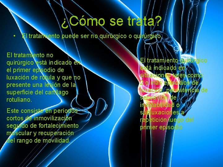 ¿Cómo se trata? • El tratamiento puede ser no quirúrgico. El tratamiento no quirúrgico