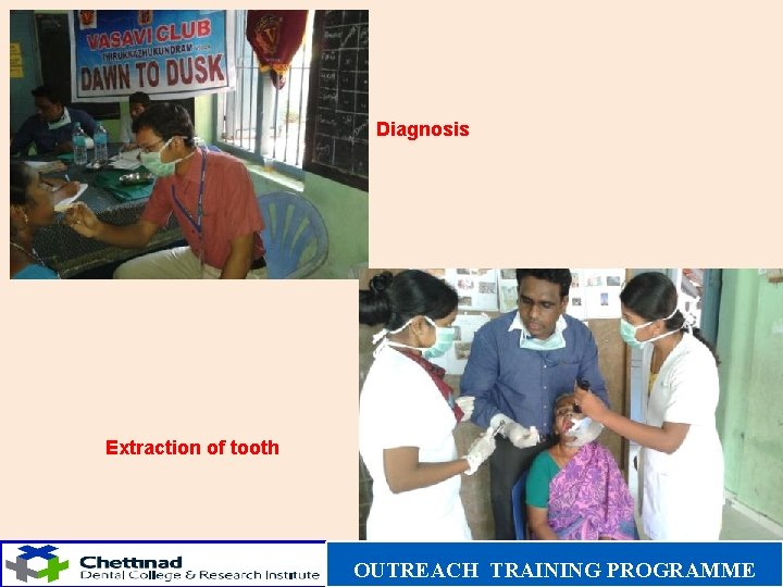 Diagnosis Extraction of tooth OUTREACH TRAINING PROGRAMME 