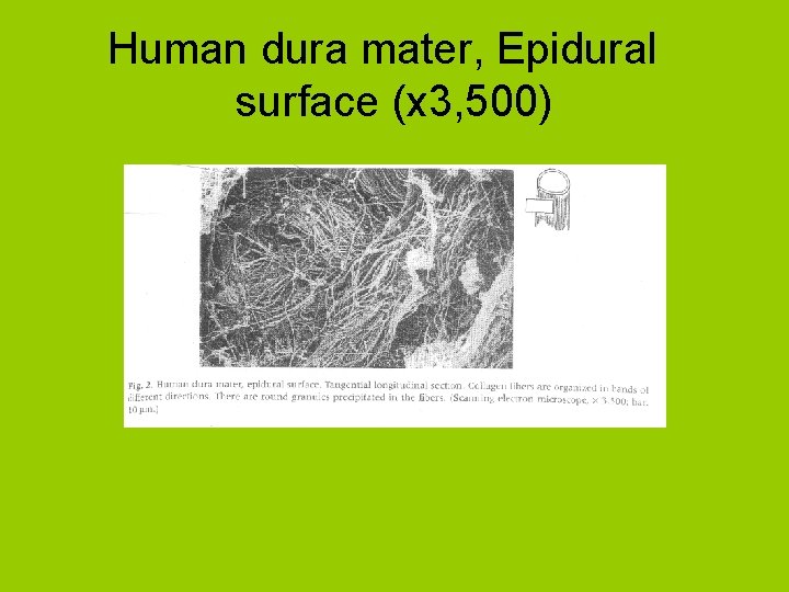 Human dura mater, Epidural surface (x 3, 500) 