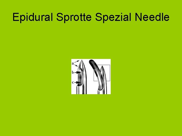 Epidural Sprotte Spezial Needle 