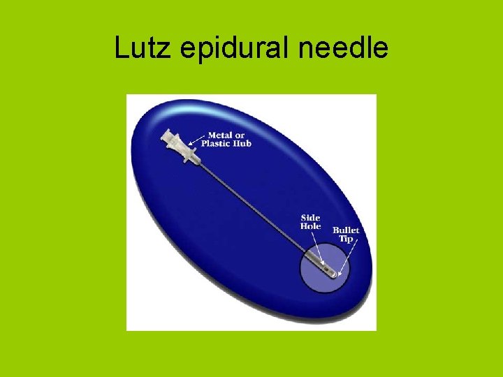 Lutz epidural needle 