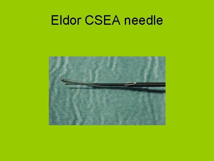 Eldor CSEA needle 