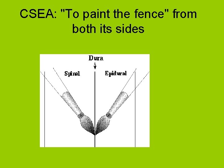 CSEA: "To paint the fence" from both its sides 