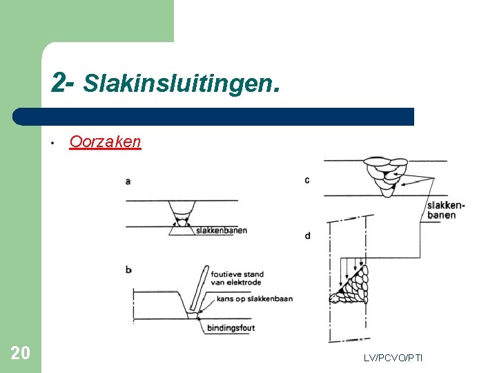 2 - Slakinsluitingen. • 20 Oorzaken LV/PCVO/PTI 