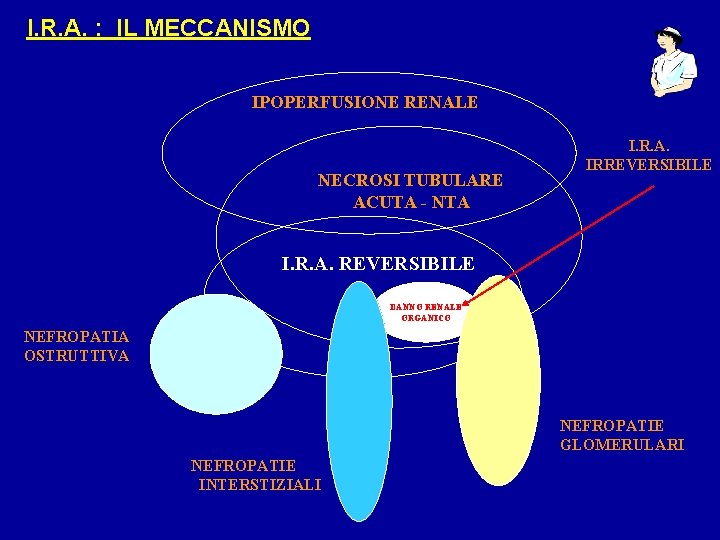 I. R. A. : IL MECCANISMO IPOPERFUSIONE RENALE NECROSI TUBULARE ACUTA - NTA I.