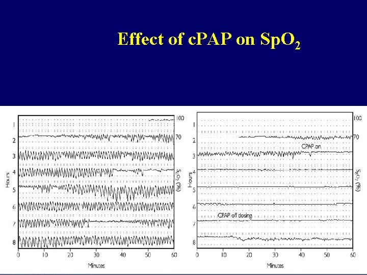 Effect of c. PAP on Sp. O 2 