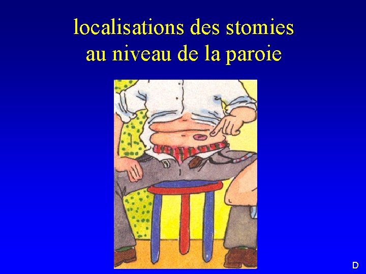 localisations des stomies au niveau de la paroie D 