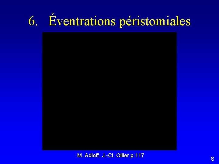 6. Éventrations péristomiales M. Adloff, J. -Cl. Ollier p. 117 S 