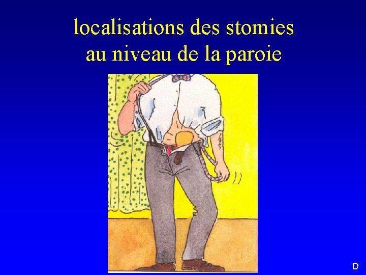 localisations des stomies au niveau de la paroie D 