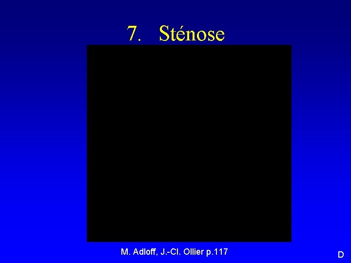 7. Sténose M. Adloff, J. -Cl. Ollier p. 117 D 