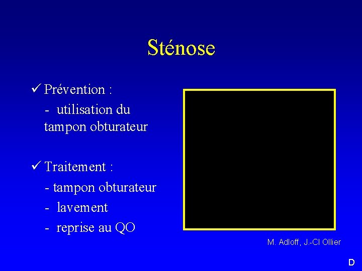 Sténose ü Prévention : - utilisation du tampon obturateur ü Traitement : - tampon