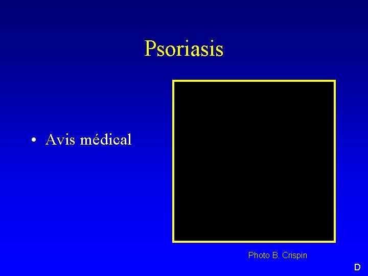 Psoriasis • Avis médical Photo B. Crispin D 