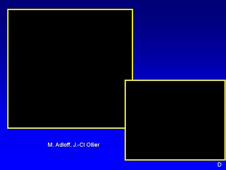 M. Adloff, J. -Cl Ollier D 