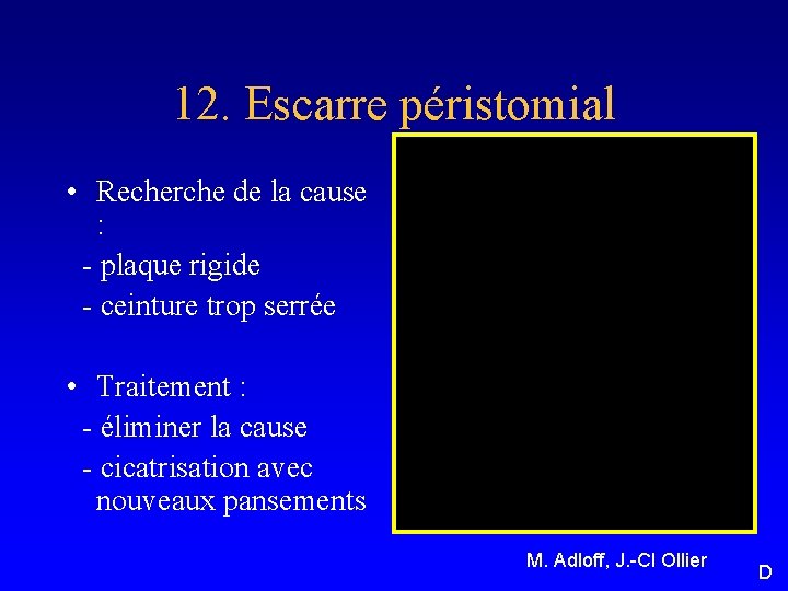 12. Escarre péristomial • Recherche de la cause : - plaque rigide - ceinture