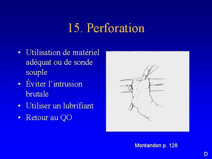 15. Perforation • Utilisation de matériel adéquat ou de sonde souple • Éviter l’intrusion