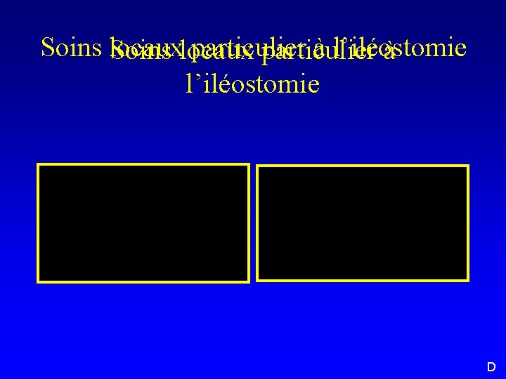 Soins locaux particulier à l’iléostomie D 