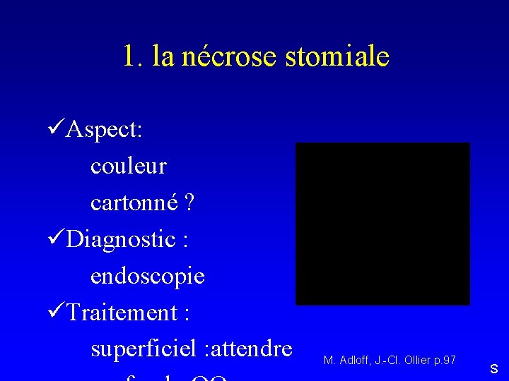 1. la nécrose stomiale üAspect: couleur cartonné ? üDiagnostic : endoscopie üTraitement : superficiel