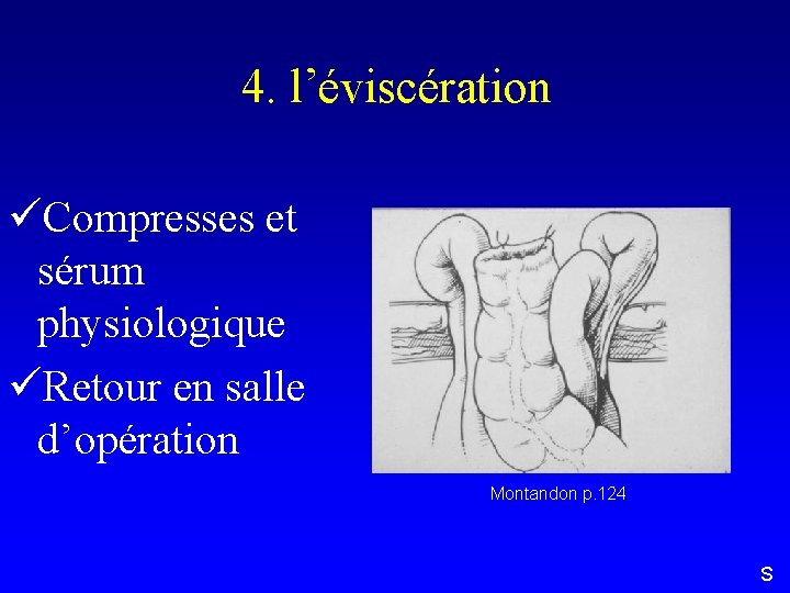 4. l’éviscération üCompresses et sérum physiologique üRetour en salle d’opération Montandon p. 124 S