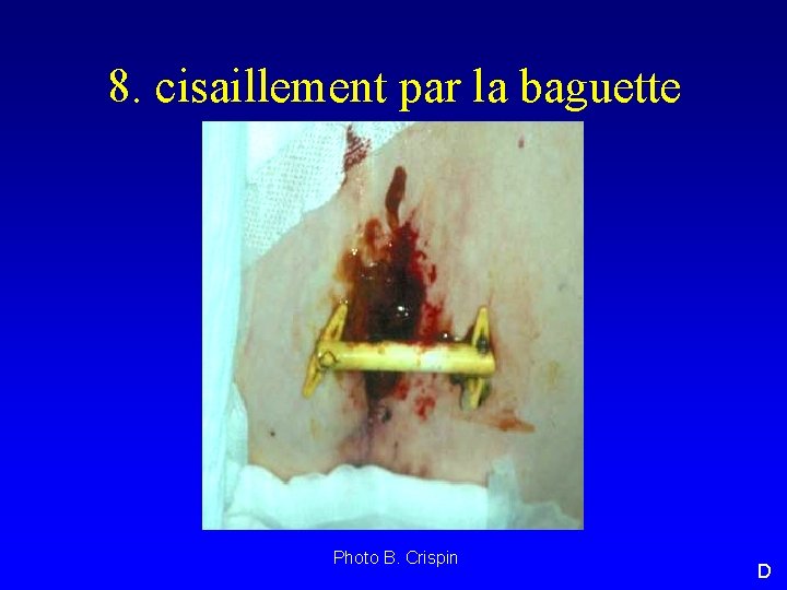 8. cisaillement par la baguette Photo B. Crispin D 