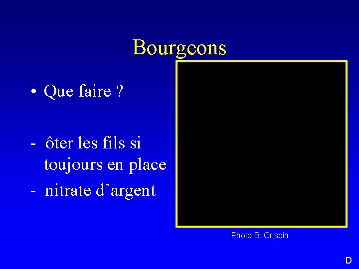 Bourgeons • Que faire ? - ôter les fils si toujours en place -