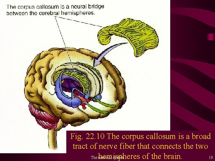 Fig. 22. 10 The corpus callosum is a broad tract of nerve fiber that