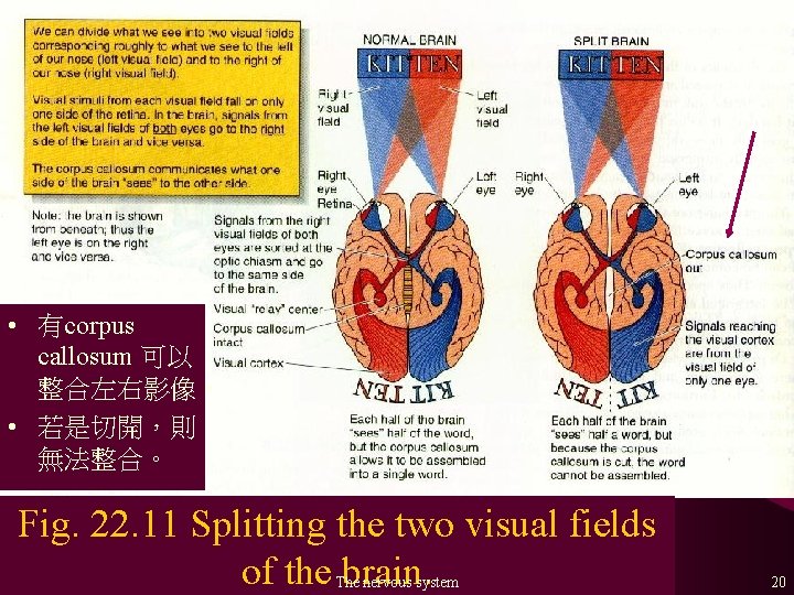  • 有corpus callosum 可以 整合左右影像。 • 若是切開，則 無法整合。 Fig. 22. 11 Splitting the