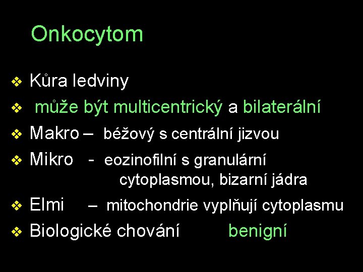 Onkocytom v Kůra ledviny v může být multicentrický a bilaterální v Makro – béžový