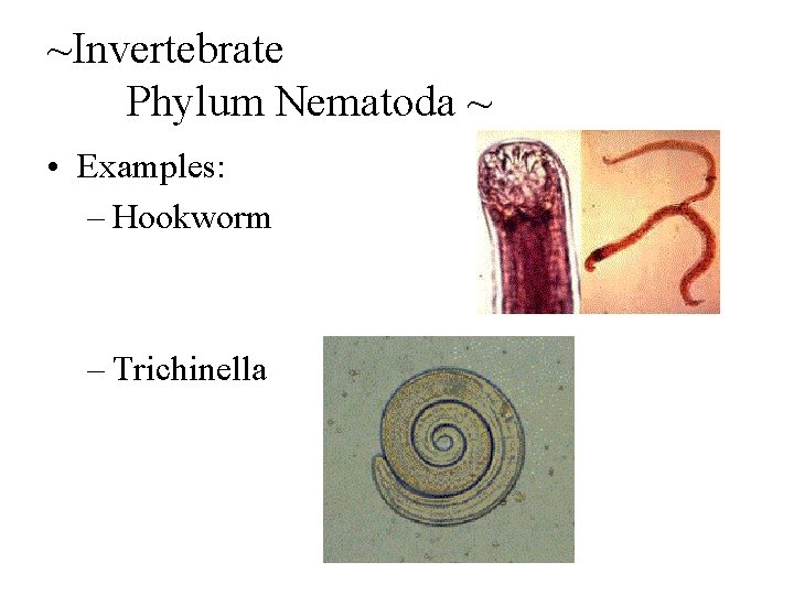 ~Invertebrate Phylum Nematoda ~ • Examples: – Hookworm – Trichinella 