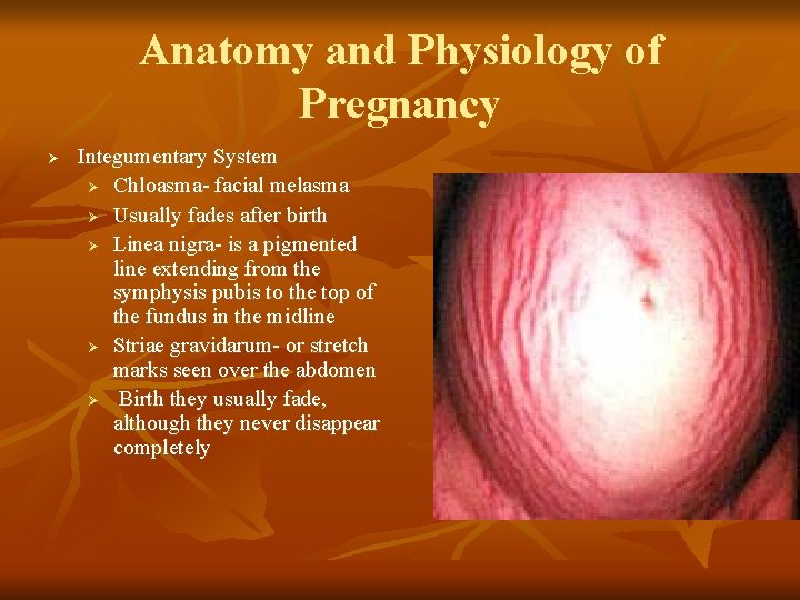 Anatomy and Physiology of Pregnancy Ø Integumentary System Ø Chloasma- facial melasma Ø Usually