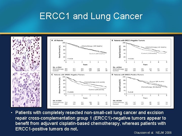 ERCC 1 and Lung Cancer • Patients with completely resected non-small-cell lung cancer and