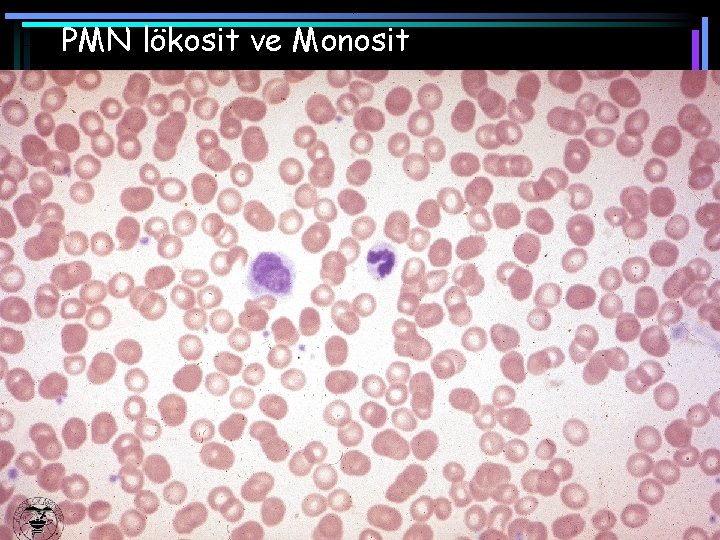 PMN lökosit ve Monosit 