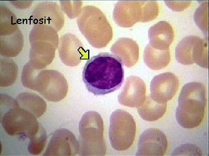 Lenfosit 