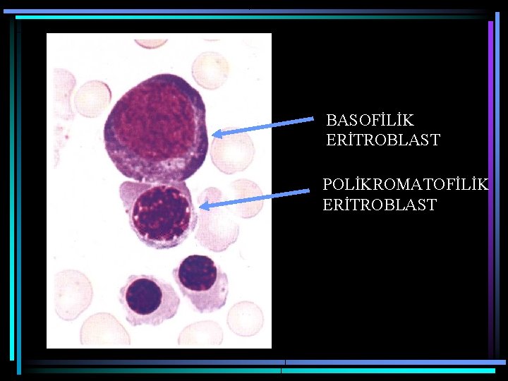 BASOFİLİK ERİTROBLAST POLİKROMATOFİLİK ERİTROBLAST 