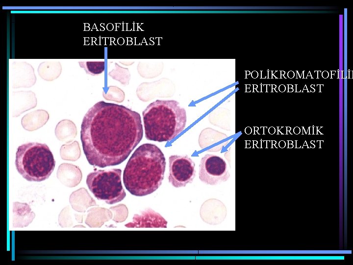 BASOFİLİK ERİTROBLAST POLİKROMATOFİLİK ERİTROBLAST ORTOKROMİK ERİTROBLAST 