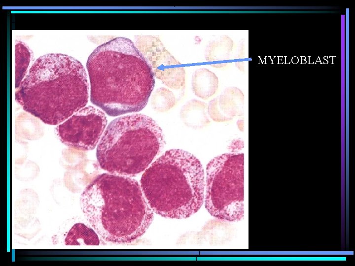 MYELOBLAST 