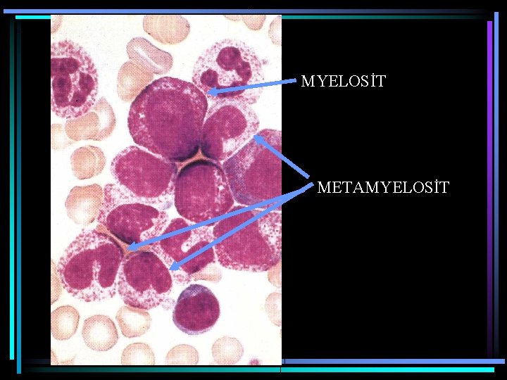 MYELOSİT METAMYELOSİT 