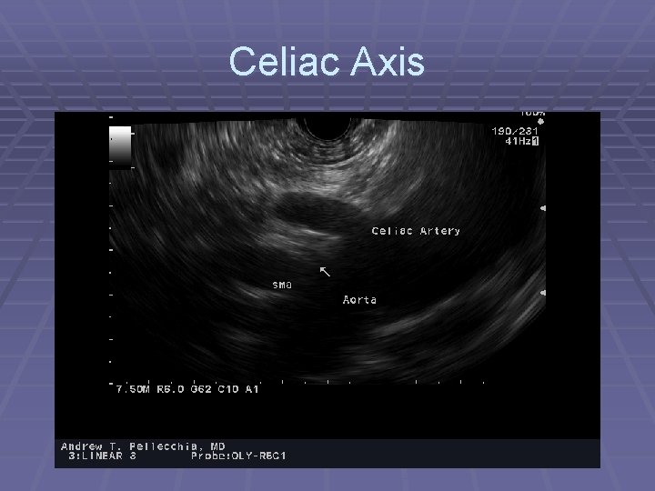Celiac Axis 