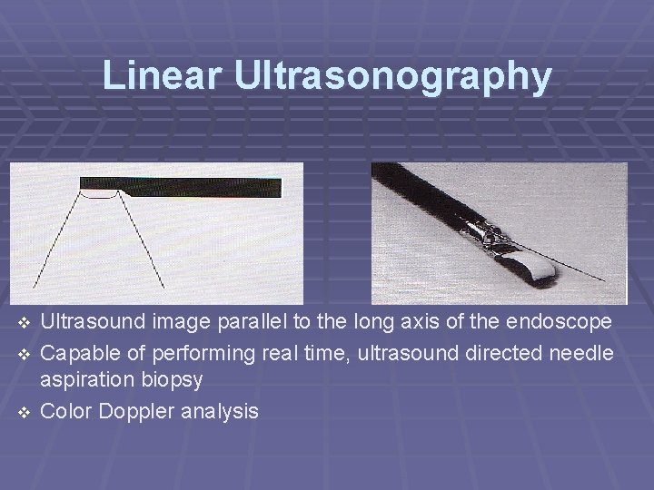 Linear Ultrasonography Ultrasound image parallel to the long axis of the endoscope Capable of