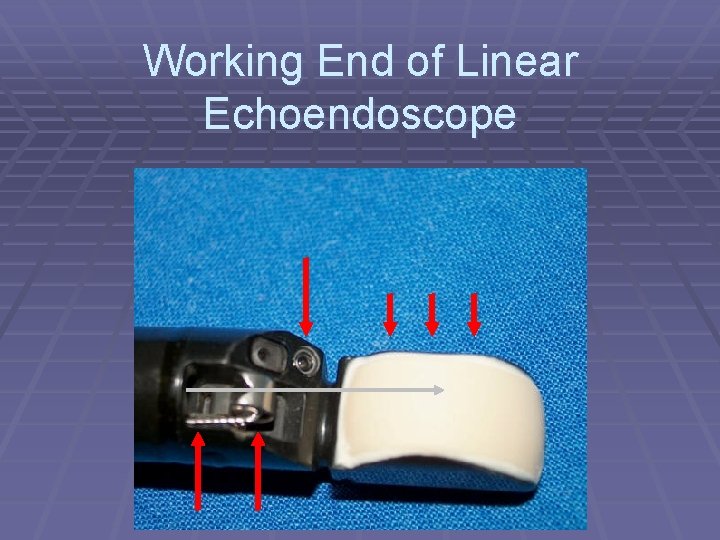Working End of Linear Echoendoscope 