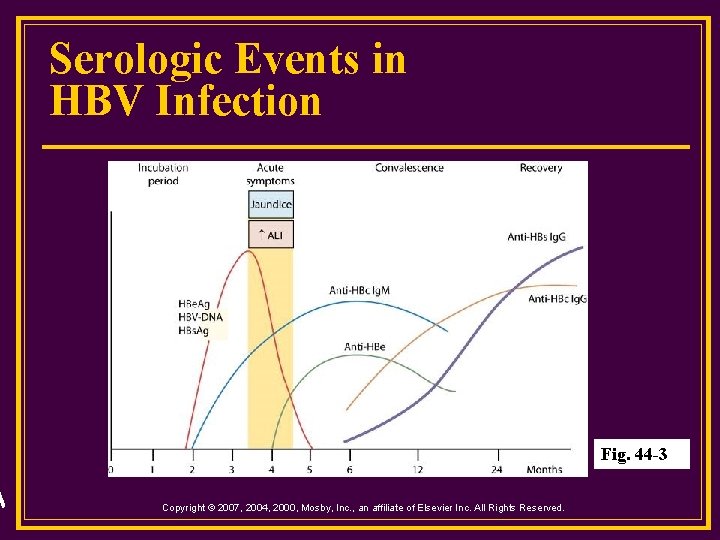 Serologic Events in HBV Infection Fig. 44 -3 Copyright © 2007, 2004, 2000, Mosby,