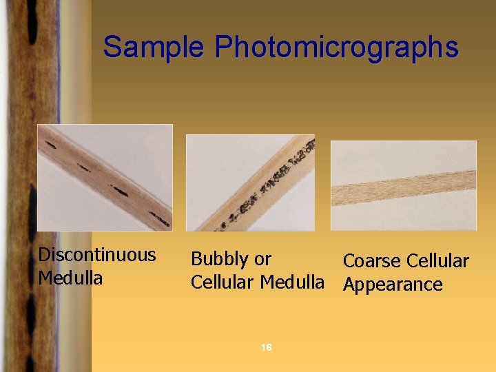 Sample Photomicrographs Discontinuous Medulla Bubbly or Coarse Cellular Medulla Appearance 16 