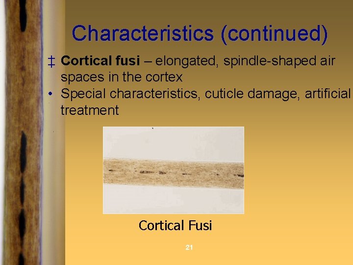 Characteristics (continued) ‡ Cortical fusi – elongated, spindle-shaped air spaces in the cortex •