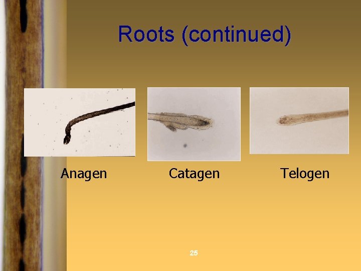 Roots (continued) Anagen Catagen 25 Telogen 