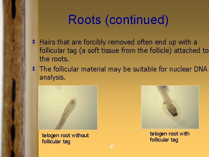 Roots (continued) ‡ Hairs that are forcibly removed often end up with a follicular